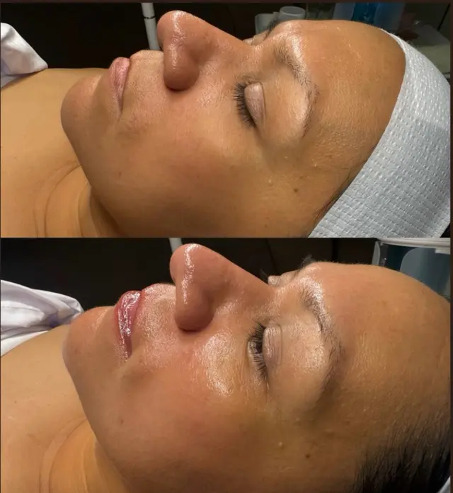 Raw Aesthetic Medical Spa by Sally Aziz — customer photo 2