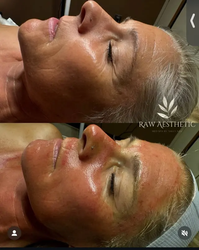Raw Aesthetic Medical Spa by Sally Aziz — photo from the business 12