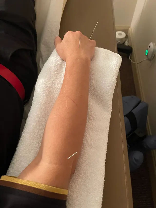 Acupuncture Wellness Center LLC — customer photo 11