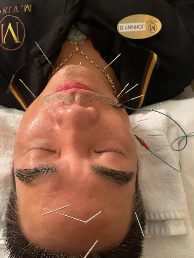 Acupuncture Wellness Center LLC — customer photo 12