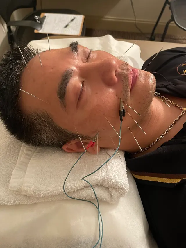 Acupuncture Wellness Center LLC — customer photo 7