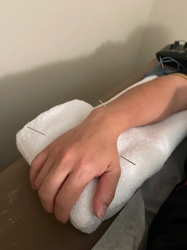 Acupuncture Wellness Center LLC — customer photo 8