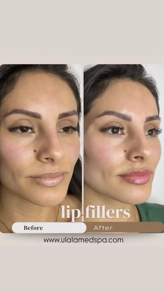 ULALA Med Spa — photo from the business 12