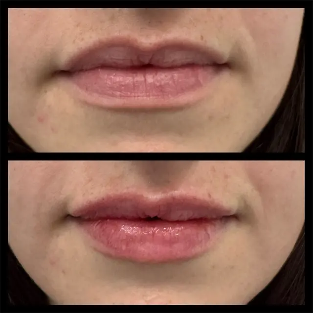 Customer photo of work by Beauty Elite Med Spa, from Izzy Forrest's review