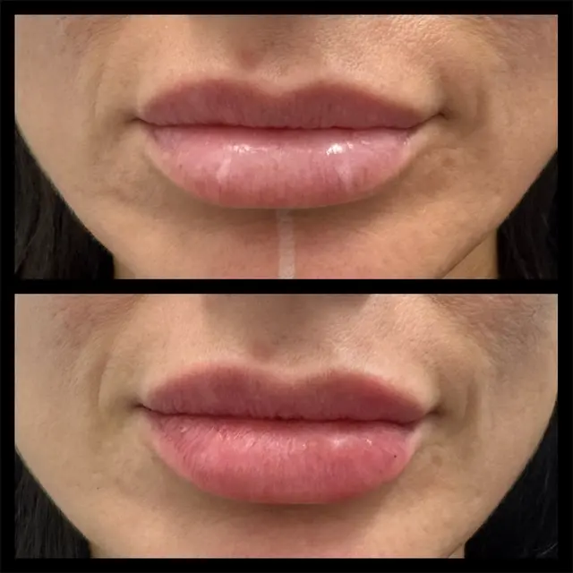 Customer photo of work by Beauty Elite Med Spa, from Darlen Escobar's review
