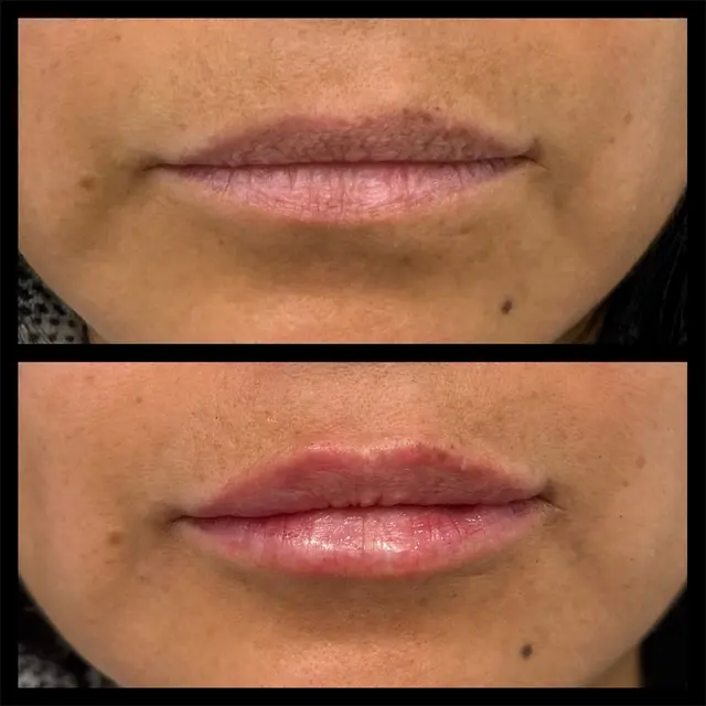 Customer photo of work by Beauty Elite Med Spa, from Patty Romero's review