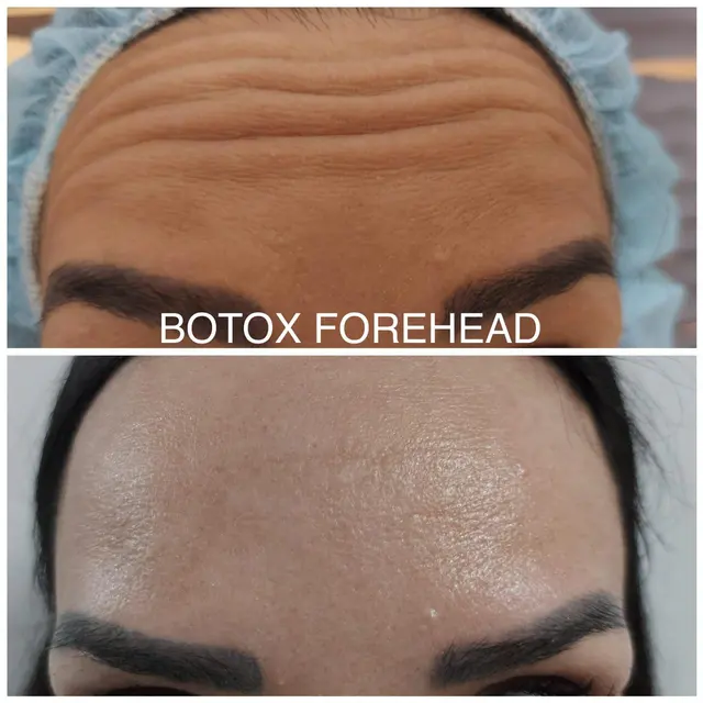 Beauty Elite Med Spa — photo from the business 11