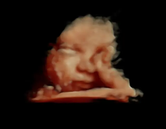 Expressions 3D/4D Ultrasounds & Photography — photo from the business 12