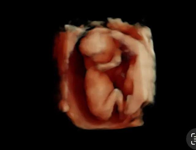 Expressions 3D/4D Ultrasounds & Photography — photo from the business 9