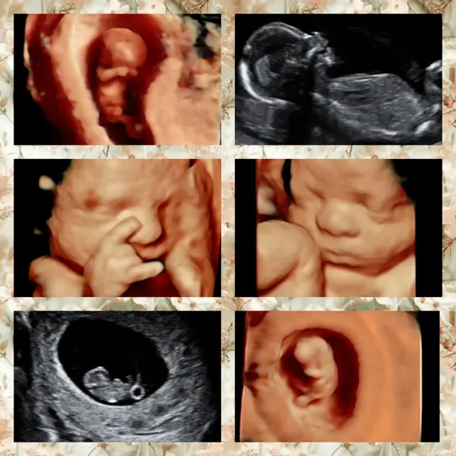 Expressions 3D/4D Ultrasounds & Photography — photo from the business 10