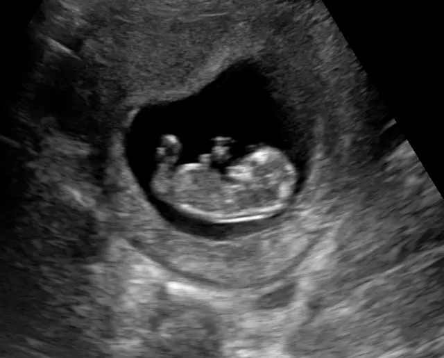 Expressions 3D/4D Ultrasounds & Photography — photo from the business 4