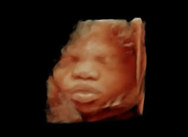 Expressions 3D/4D Ultrasounds & Photography — photo from the business 11