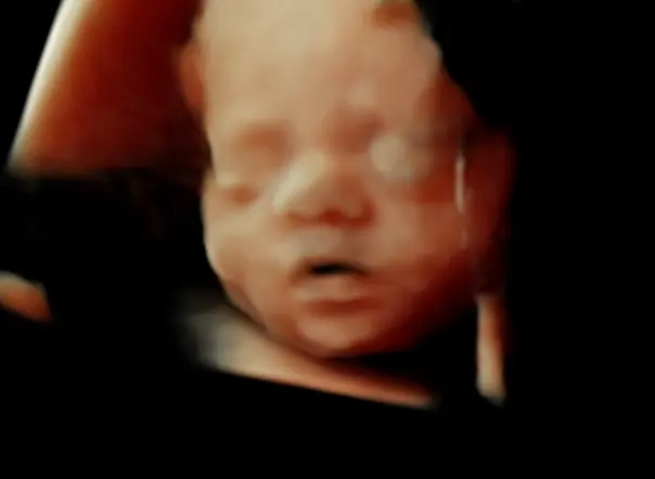 Expressions 3D/4D Ultrasounds & Photography — photo from the business 8