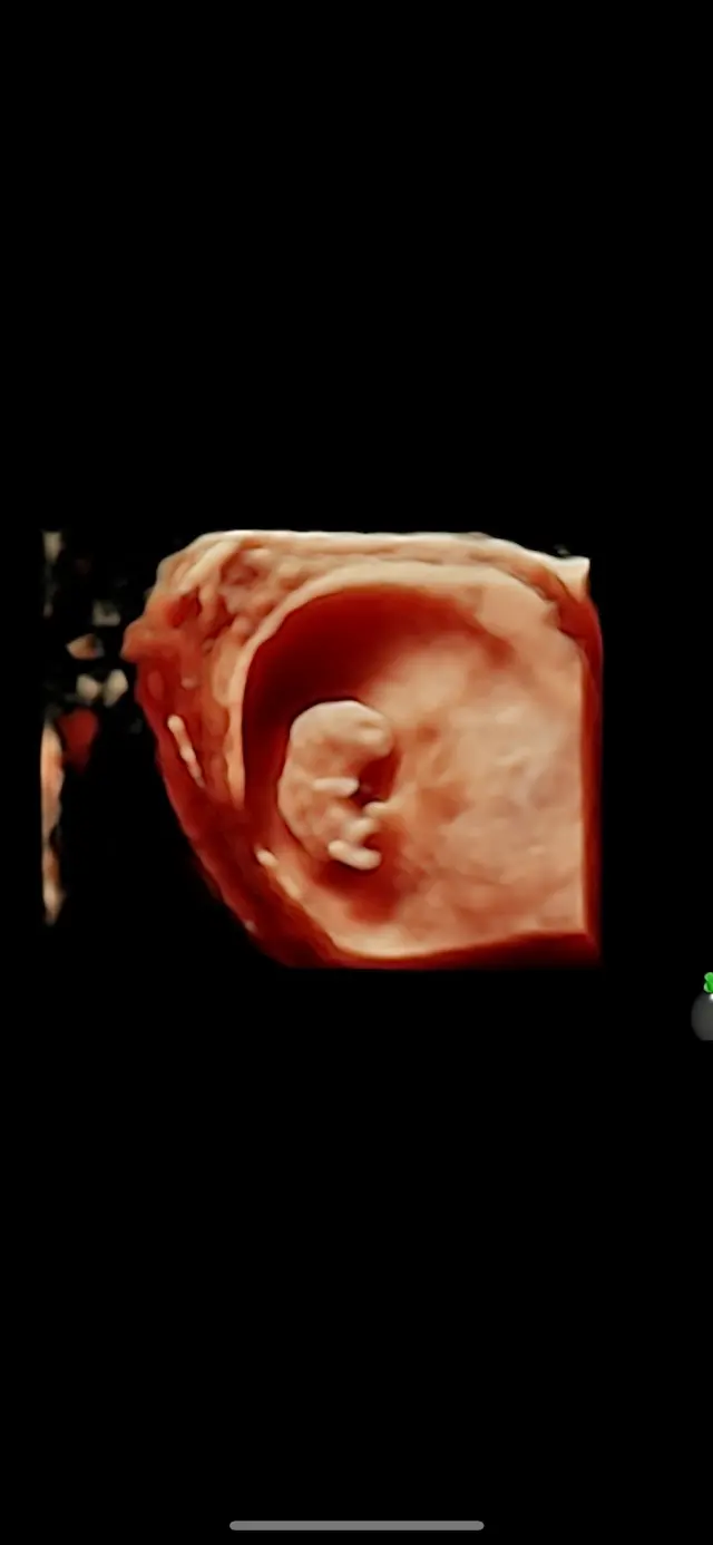 Expressions 3D/4D Ultrasounds & Photography — photo from the business 6
