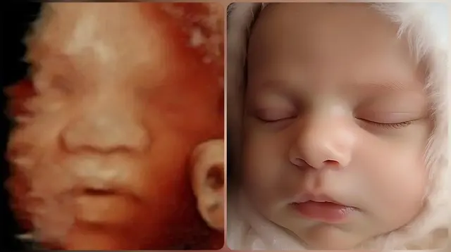 Expressions 3D/4D Ultrasounds & Photography — photo from the business 2