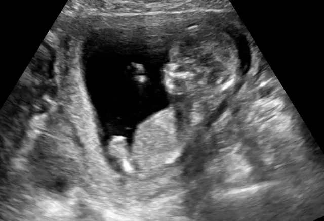 Expressions 3D/4D Ultrasounds & Photography — photo from the business 7