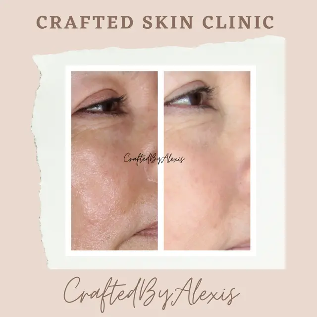 Crafted Skin Clinic — photo from the business 10