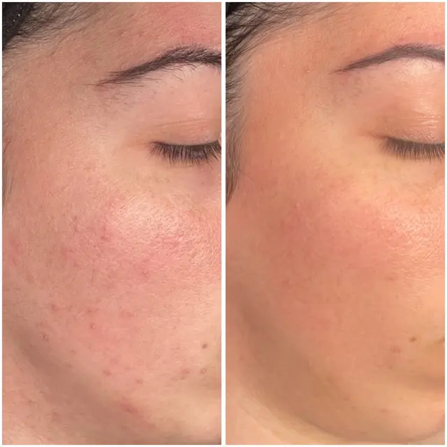 Just Peachie Wellness and Aesthetics — photo from the business 11