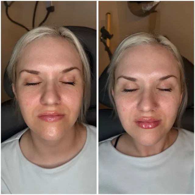 Just Peachie Wellness and Aesthetics — photo from the business 9