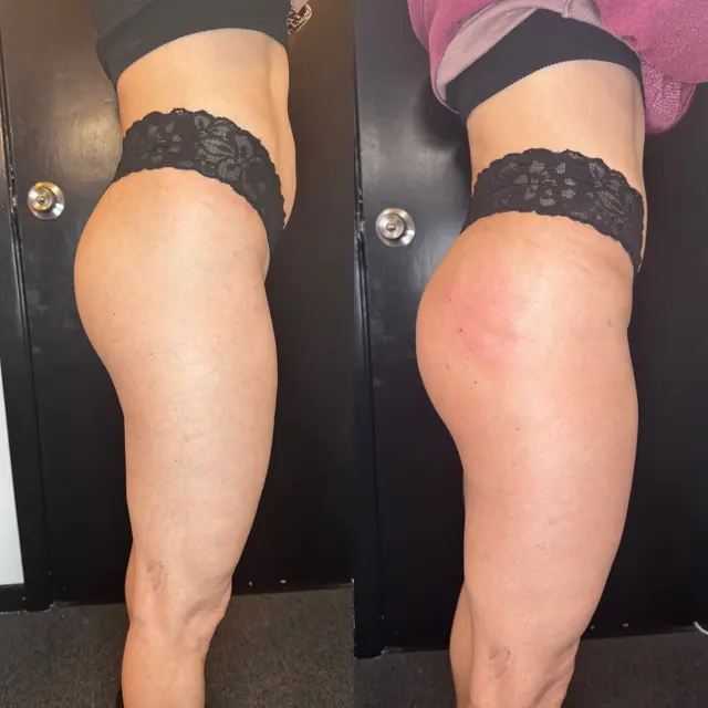 Just Peachie Wellness and Aesthetics — photo from the business 10